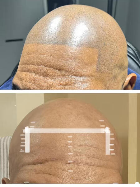 Before and After