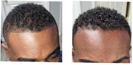 Before and After